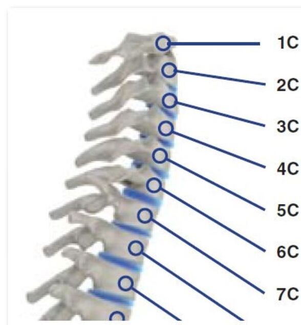 Rook sindrome