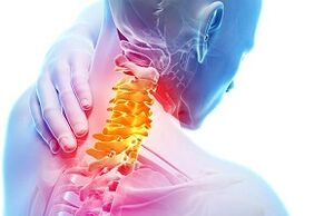Osteokondrosia eta elikadura gaixotasun arauen sintomak