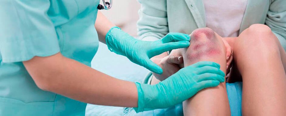 mediku batek belauneko lesio bat aztertzen du